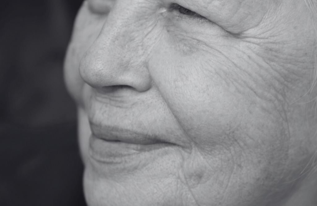 Close-up of dry, dehydrated skin on a woman's face