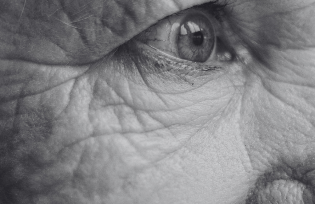 Close-up of mature woman's face showing skin sagging and loss of firmness